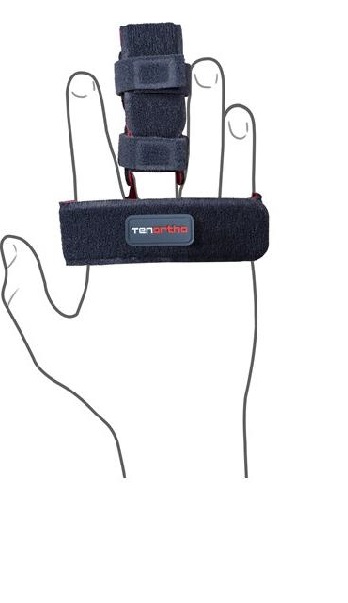 TUTORE PER DITA TENORTHO DITO 1 BAMBINO CIRCONFERENZA PALMOINFERIORE AI 18CM AMBIDESTRO GRIGIO ANTRACITE
